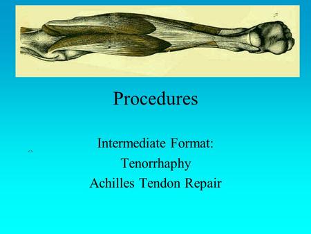 Intermediate Format: Tenorrhaphy Achilles Tendon Repair