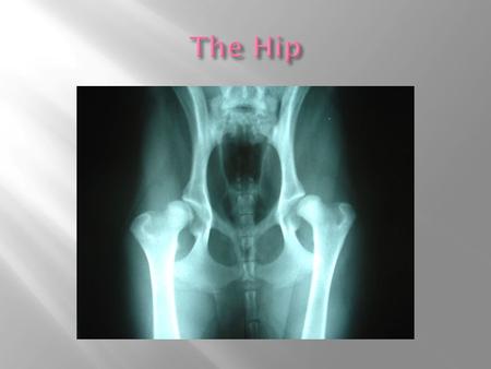  The Hip is a ball and socket joint like the shoulder, but because it is me stable it has less motion than the shoulder.