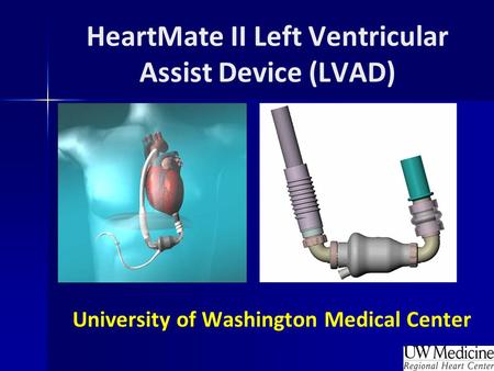 BACKGROUND Ventricular assist devices (VADs) are a proven therapy as bridge-to-cardiac transplantation in Class IIIB and Class IV heart failure patients.