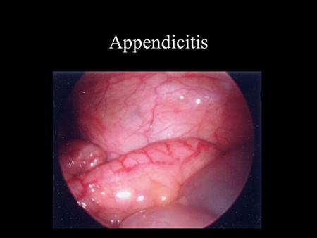 Appendicitis. Pathophysiology Obstruction of lumen causes diffuse pain Intraluminal bacterial overgrowth causes: –Mucosal breakdown –Bacterial invasion.