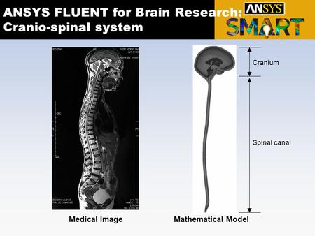 ANSYS FLUENT for Brain Research: Cranio-spinal system