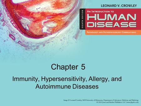 Immunity, Hypersensitivity, Allergy, and Autoimmune Diseases