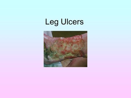 Leg Ulcers. Introduction Define Leg ulcer Introduce the scenario Identify the main causes and conditions Assessment and planning of scenario Discuss the.