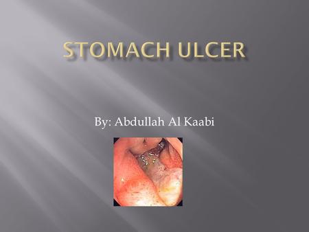By: Abdullah Al Kaabi.  The most common symptom of a stomach ulcer is a burning pain that develops in the upper abdomen or the centre of your abdomen.