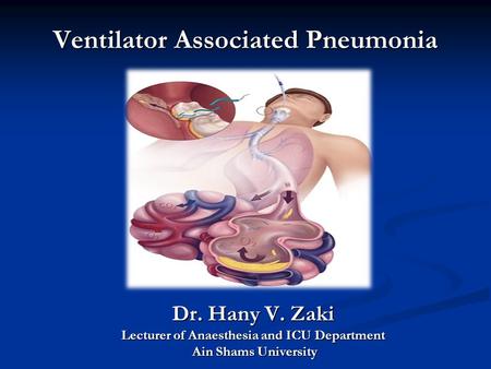 Ventilator Associated Pneumonia