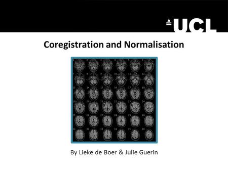 Coregistration and Normalisation By Lieke de Boer & Julie Guerin.