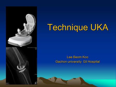 Lee Beom Koo Gachon university Gil Hospital Technique UKA Technique UKA.
