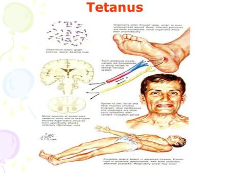 Tetanus.