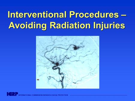 INTERNATIONAL COMMISSION ON RADIOLOGICAL PROTECTION —————————————————————————————————————— Interventional Procedures – Avoiding Radiation Injuries.