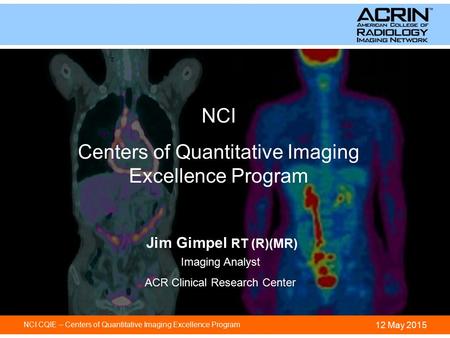 12 May 2015 ACR TRIAD IMAGE MANAGEMENT SYSTEM NCI CQIE – Centers of Quantitative Imaging Excellence Program NCI Centers of Quantitative Imaging Excellence.