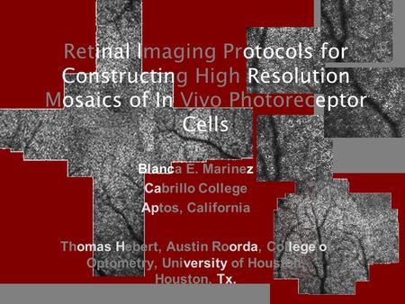 Retinal Imaging Protocols for Constructing High Resolution Mosaics of In Vivo Photoreceptor Cells Blanca E. Marinez Cabrillo College Aptos, California.