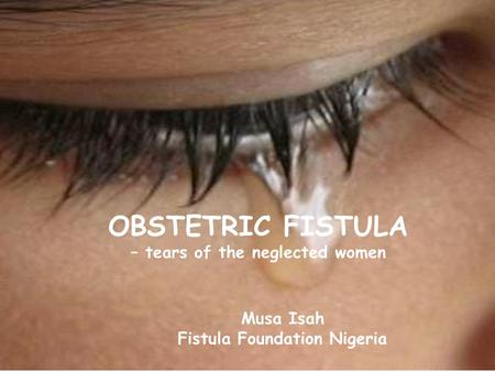 OBSTETRIC FISTULA – tears of the neglected women Musa Isah Fistula Foundation Nigeria.
