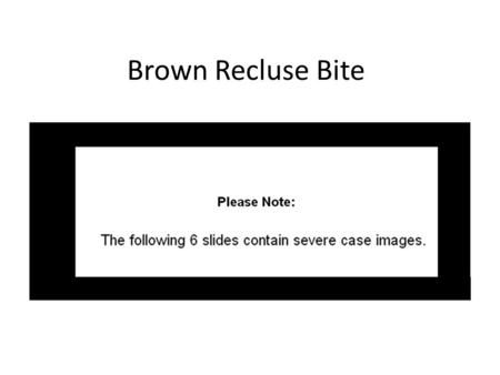 Brown Recluse Bite.