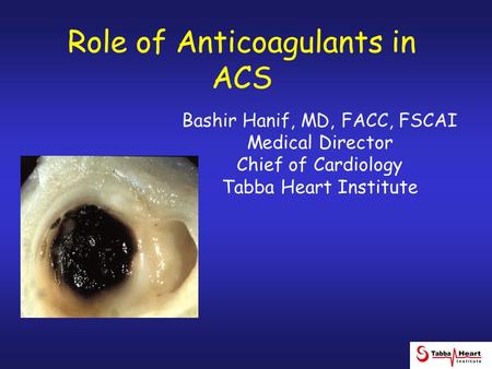Role of Anticoagulants in ACS