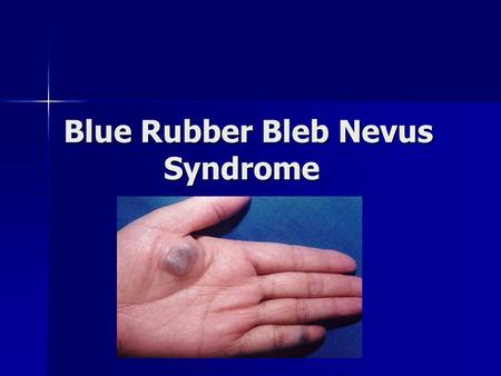 Blue Rubber Bleb Nevus Syndrome. History  In 1860, Gascoyen first described an association between cavernous hemangiomas of the skin and similar lesions.