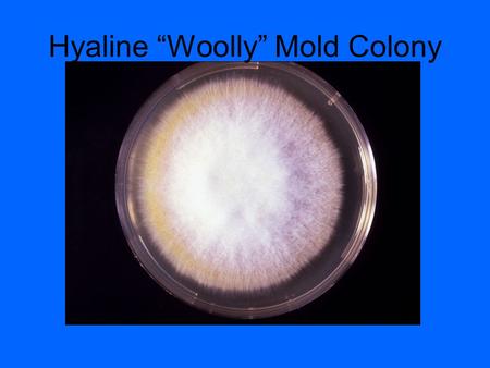 Hyaline “Woolly” Mold Colony. Dematacious (Dark Colored) Mold Colony.