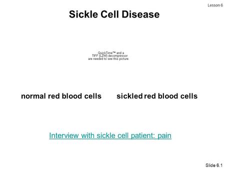 Sickle Cell Disease normal red blood cells sickled red blood cells