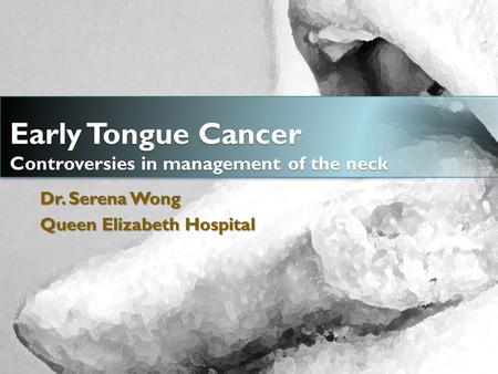 Early Tongue Cancer Controversies in management of the neck Dr. Serena Wong Queen Elizabeth Hospital.
