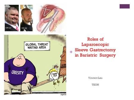 Roles of Laparoscopic Sleeve Gastrectomy in Bariatric Surgery