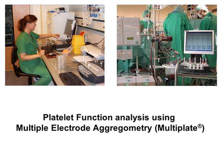Platelet Function analysis using Multiple Electrode Aggregometry (Multiplate ® )