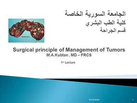 Surgical principle of Management of Tumors M.A.Kubtan, MD – FRCS 1 st Lecture 1M.A.Kubtan.