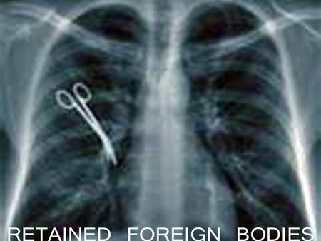 RETAINED FOREIGN BODY In this case, a retained foreign body is an object, typically a surgical instrument, gauze or sponge, that has been left inside.