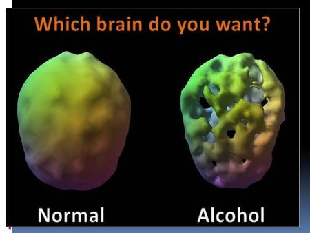 TEENAGERS: DRINKING AND DRUGS A 15 year old’s brain image: Not a drinker A 15 year old’s brain image: a drinker.