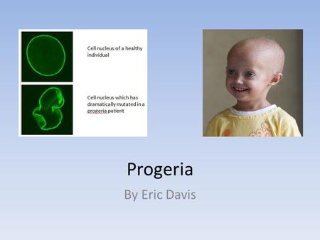 Progeria By Eric Davis.