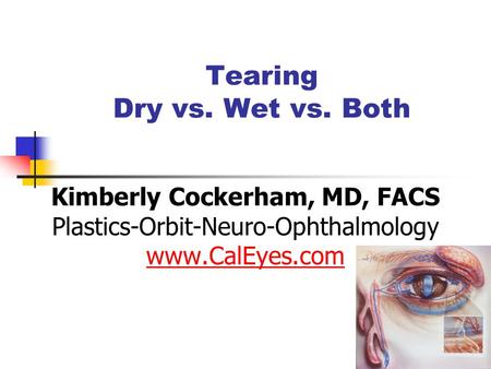 Tearing Dry vs. Wet vs. Both Kimberly Cockerham, MD, FACS Plastics-Orbit-Neuro-Ophthalmology www.CalEyes.com.