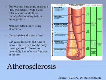 Atherosclerosis Buildup and hardening of plaque - fat, cholesterol, white blood cells, calcium, and others. Usually due to injury to inner lining (intima)