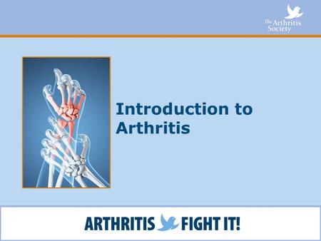 Introduction to Arthritis. What You Will Learn Facts about arthritis What you can do about arthritis How The Arthritis Society can help How you can get.
