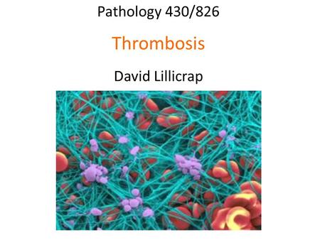 Pathology 430/826 Thrombosis David Lillicrap. Cardiovascular Disease 30% of all deaths in Canada 54% ischemic heart disease 20% stroke 23% heart attack.