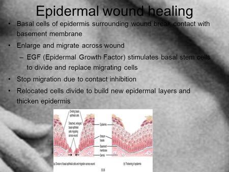 Epidermal wound healing Basal cells of epidermis surrounding wound break contact with basement membrane Enlarge and migrate across wound –EGF (Epidermal.