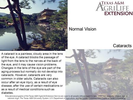 Normal Vision Cataracts A cataract is a painless, cloudy area in the lens of the eye. A cataract blocks the passage of light from the lens to the nerves.
