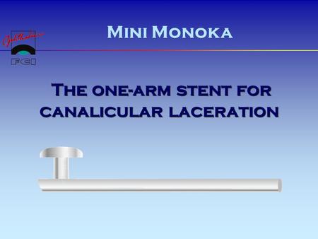 The one-arm stent for canalicular laceration The one-arm stent for canalicular laceration Mini Monoka.