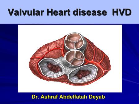 Valvular Heart disease HVD By Dr. Ashraf Abdelfatah Deyab.