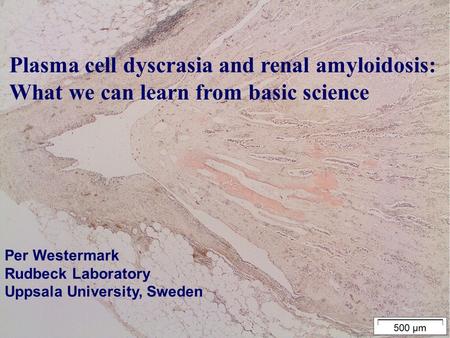 Plasma cell dyscrasia and renal amyloidosis: What we can learn from basic science Per Westermark Rudbeck Laboratory Uppsala University, Sweden.