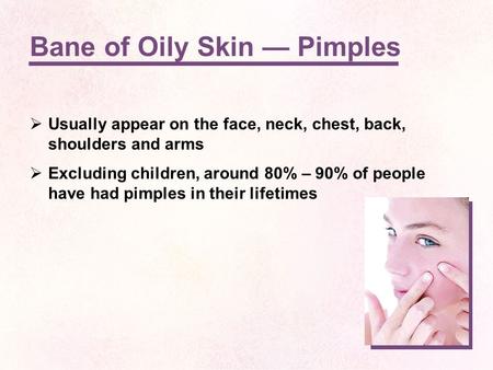 Bane of Oily Skin — Pimples  Usually appear on the face, neck, chest, back, shoulders and arms  Excluding children, around 80% – 90% of people have had.