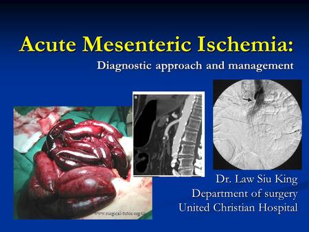 Acute Mesenteric Ischemia: Diagnostic approach and management