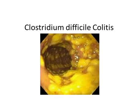 Clostridium difficile Colitis. C. diff.—Gram stain.