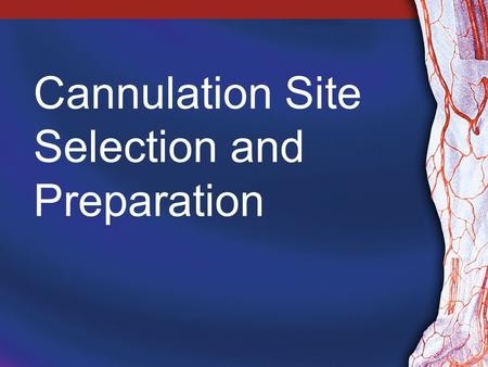 Cannulation Site Selection and Preparation