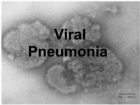 Viral Pneumonia. Caused by bacteria or several viruses Respiratory Syncytial Virus.
