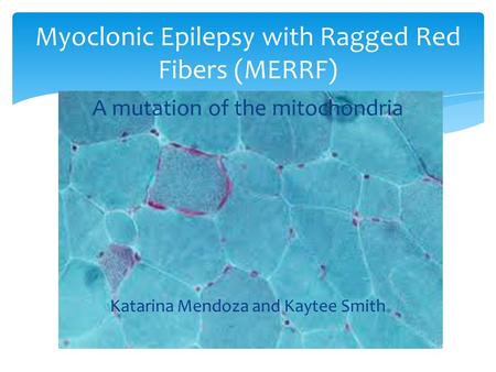 A mutation of the mitochondria Katarina Mendoza and Kaytee Smith Myoclonic Epilepsy with Ragged Red Fibers (MERRF)