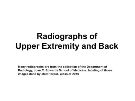 Radiographs of Upper Extremity and Back Many radiographs are from the collection of the Department of Radiology, Joan C. Edwards School of Medicine; labeling.