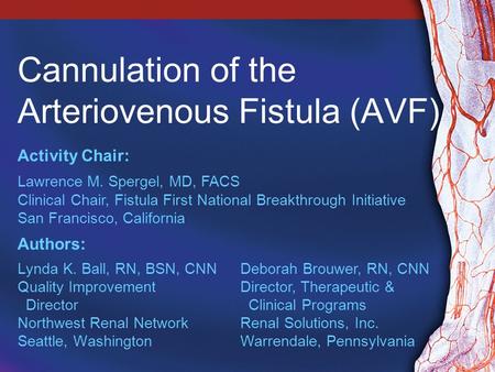 Cannulation of the Arteriovenous Fistula (AVF)