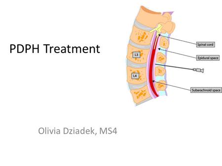 PDPH Treatment Olivia Dziadek, MS4.