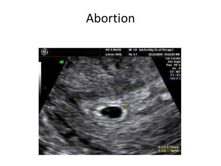 Abortion. What is abortion? Abortion: the deliberate killing of an unborn human life by means of medical and surgical procedures From ancient times through.
