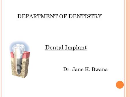 DEPARTMENT OF DENTISTRY Dental Implant Dr. Jane K. Bwana.