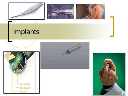 Implants. Implants: Definition: A sterile drug delivery device for subcutaneous implantation having the ability to deliver drug at a controlled rate over.