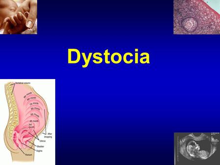 Dystocia. 2 Breastfeeding 3 What is lactogenesis? Lactogenesis is a series of cellular changes by which mammary epithelial cells differentiate and mature.